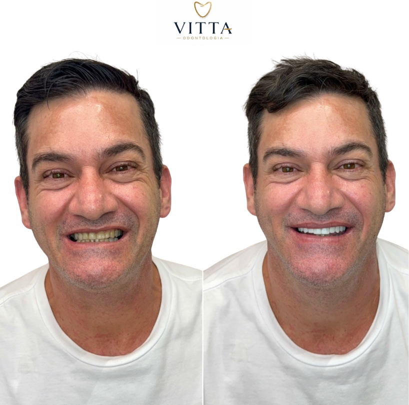 Caso de sucesso Odontologia Estética 2